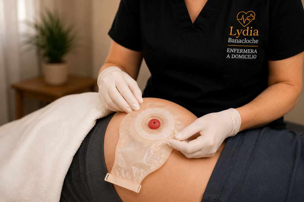 Cuidados de ostomía a domicilio realizados por enfermera en Camp de Túria
